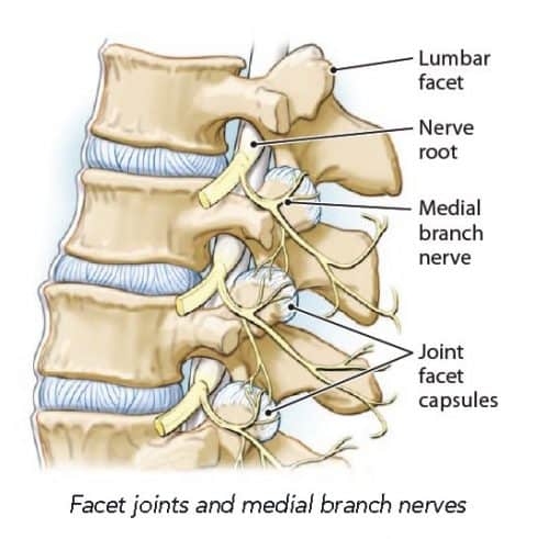 facet-joint-nerves1 - Florida Joint and Spine Institute