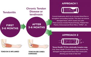 TENDON PAIN