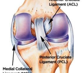 Common Causes of Severe Knee Pain